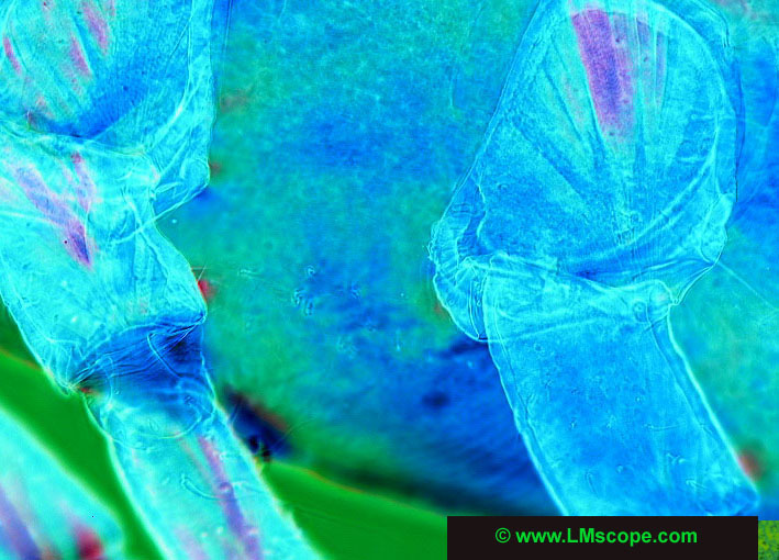 Imagen tomada de http://www.lmscope.com/produkt22/Zecke/zecke33.JPG&imgrefurl=http://www.lmscope.com/produkt22/garrapato_es.shtml&h=510&w=709&sz=106&hl=es&start=12&tbnid=pqMsx64Df6hYzM:&tbnh=101&tbnw=140&prev=/images%3Fq%3Dmicroscopio%2Bde%2Bpolarizaci%25C3%25B3n%26gbv%3D2%26svnum%3D10%26hl%3Des