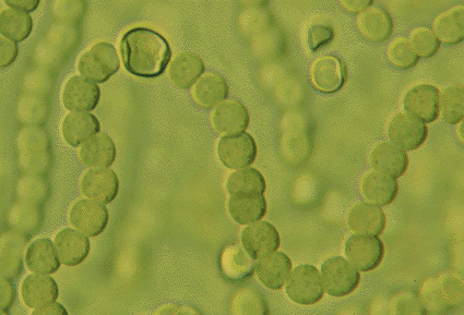 Nostoc es un tipo de alga cianofícea