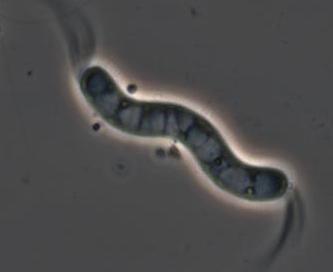 Imagen tomada de http://www.medicinapreventiva.com.ve/articulos/imagenes/leptosp1.jpg&imgrefurl=http://www.medicinapreventiva.com.ve/articulos/leptospirosis.htm&h=205&w=183&sz=2&hl=es&start=3&tbnid=7s3wY14WPg99lM:&tbnh=105&tbnw=94&prev=/images%3Fq%3Dmicroscopio%2Bde%2Bcampo%2Boscuro%26gbv%3D2%26svnum%3D10%26hl%3Des