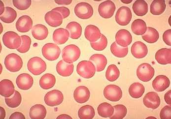 Glóbulos rojos en sangre humana