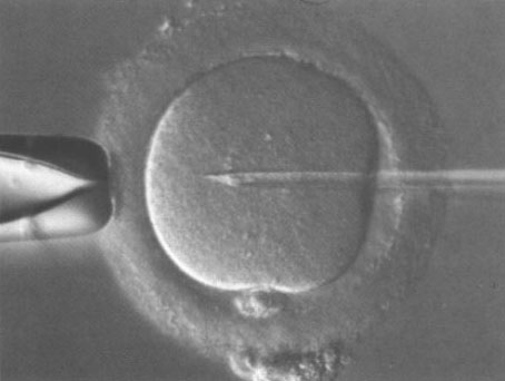 Fecundación "in vitro" de un óvulo.