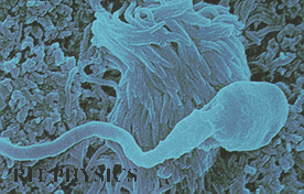 Espermatozoide