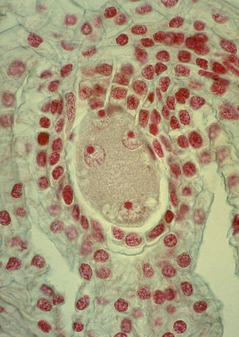 "ovulo de angiosperma"
