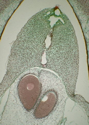 "ovulo de gimnosperma"