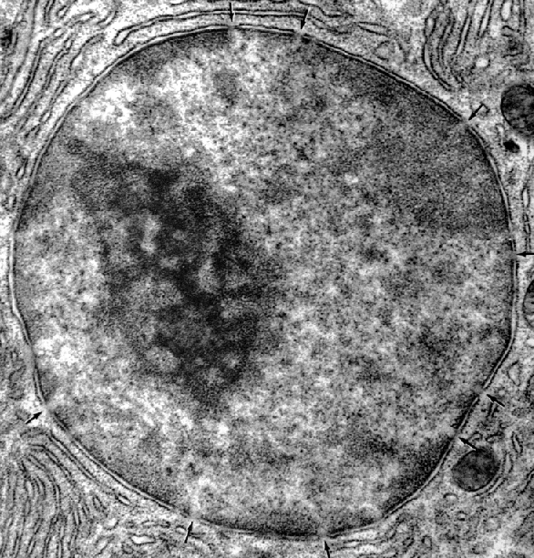 Núcleo de célula eucariota, con el nucleolo a su izquierda, lugar donde se encuentra una gran concentración de precursores de ARN.