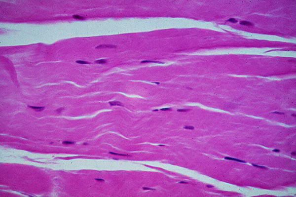 El tejido conjuntivo contiene gran cantidad de colágeno. Imagen de http://escuela.med.puc.cl/paginas/Cursos/segundo/histologia/HistologiaWeb/paginas/fotosBig/Fotos/c95CK203.jpg