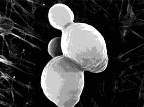 Saccharomyces cerevisiae vista al microscopio electrónico. Imagen tomada de http://www.engormix.com/microscopia.jpg