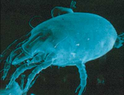 Ácaro visto con el microscopio electrónico
