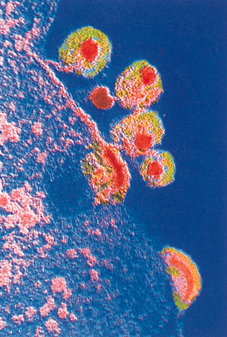 Virus infectando una célula