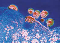 Virus de SIDA y células infectadas