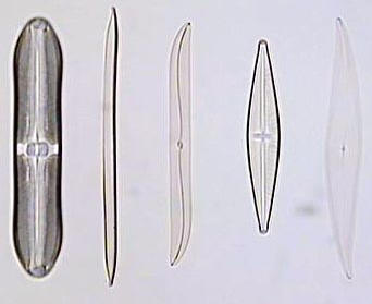 Caparazones de Diatomeas