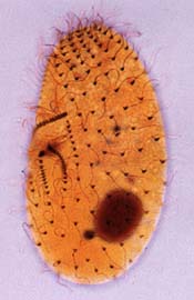 Protozoo ciliado