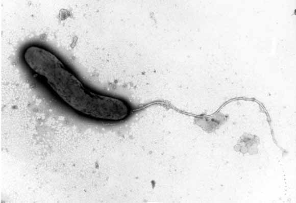 Los vibriones son bacterias alargadas, con un estremo más estrecho, dando forma de "coma ortográfica".