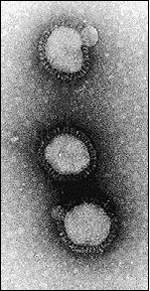 Virus de la gripe. Presenta envoltura