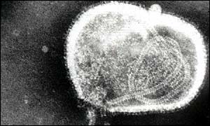 Virus de la gripe, al microscopio electrónico