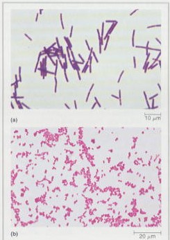 Bacterias Gram + (arriba), y Gram - (abajo).