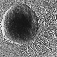 Metanococcus