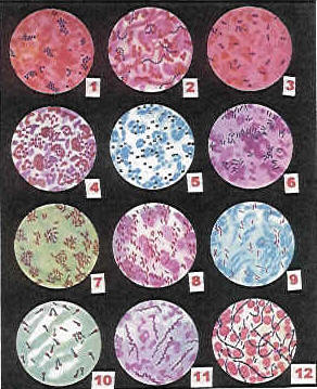 Observación de distintas bacterias a microscopía óptica