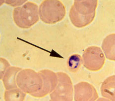 Plasmodium dentro de un glóbulo rojo