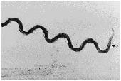 Los espirilos son bacterias con forma de muelle