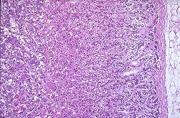 cápsulas suprarrenales al microscopio