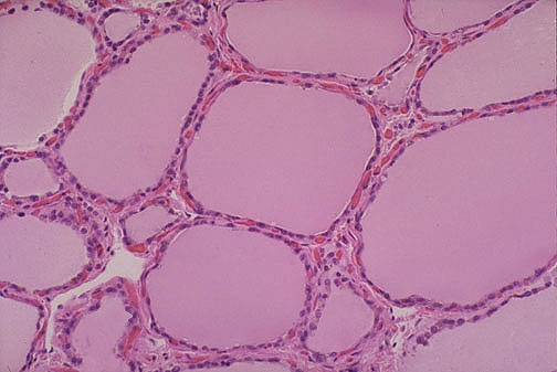 folículos del Tiroides al microscopio
