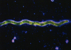 Treponema pallidum, bacteria de la Sífilis