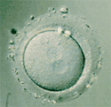 cigoto
