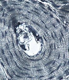 Tejido óseo compacto, visto al microscopio