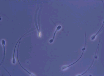 "Imagen de espermatozoides de perro, obtenida por la Universidad de Murcia"